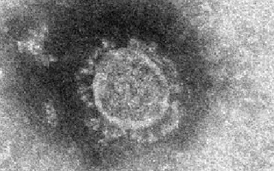 新型コロナウイルス（オミクロン株）の顕微鏡画像